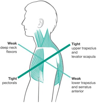 Relief from shoulder pain is possible with this expertly constructed at home yoga program for women one 50